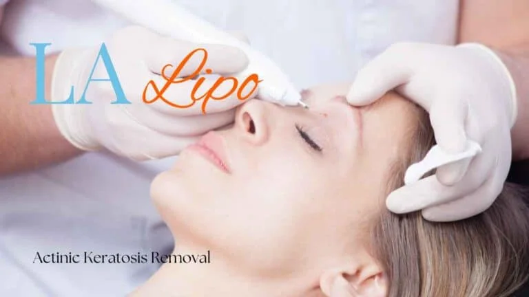 Woman receiving Actinic Keratosis Removal Treatment Greater London (Kingston upon Thames)