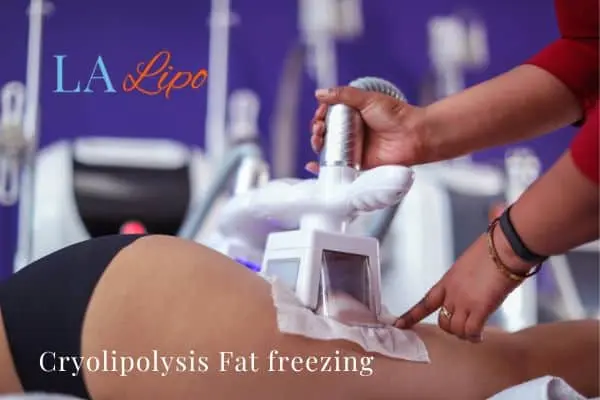 women getting fat freezing Greater London (Kingston upon Thames)