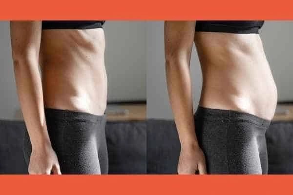 LA-EMS Body Sculpting results Greater London (Kingston upon Thames)
