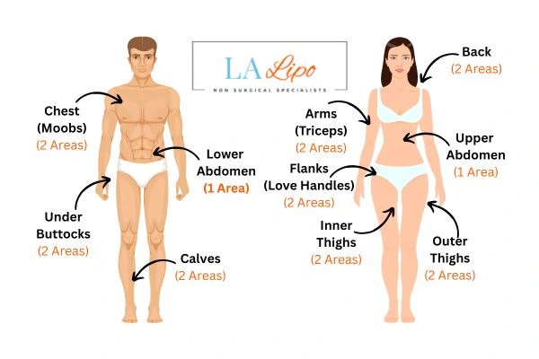 LA LIPO Cryolipolysis Areas Greater London (Kingston upon Thames)