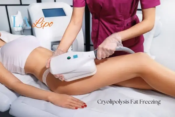 Woman receiving coolsculpting Greater London (Kingston upon Thames) treatment on her thighs