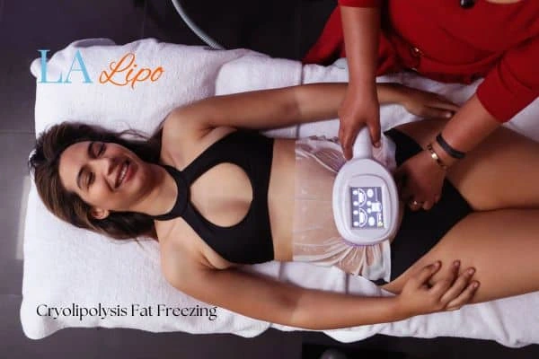 woman getting cryolipolysis Greater London (Kingston upon Thames)