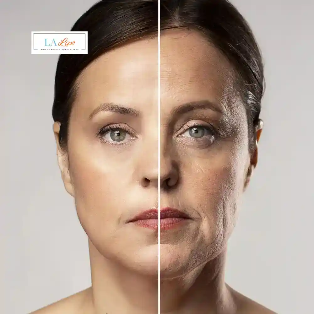 How Can You Tell If Non-Surgical Skin Tightening Is Right for You Greater London (Kingston upon Thames)?